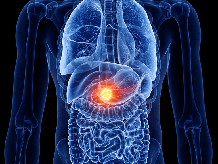 image depicting x-ray view of human torso with pancreas highlighted